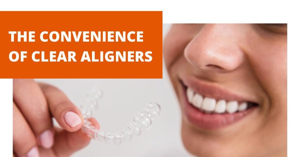 The Convenience of Clear Aligners