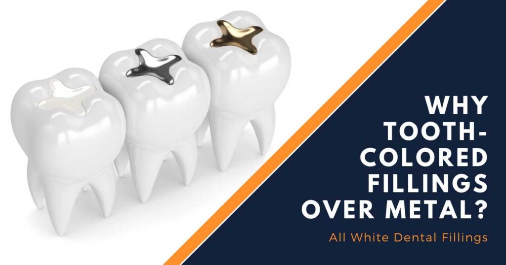 Why Choose Tooth Colored Fillings Over Metal Fillings