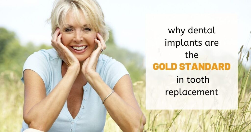 Why Dental Implants are the Gold Standard