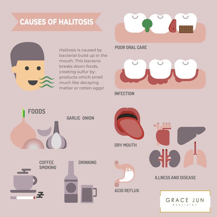 Causes of Halitosis Infographic