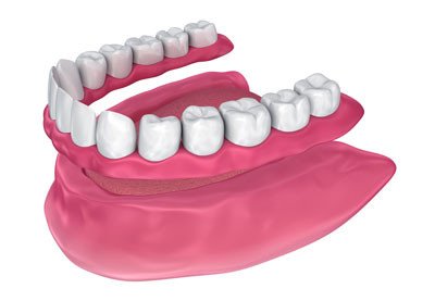 Complete Removable Dentures