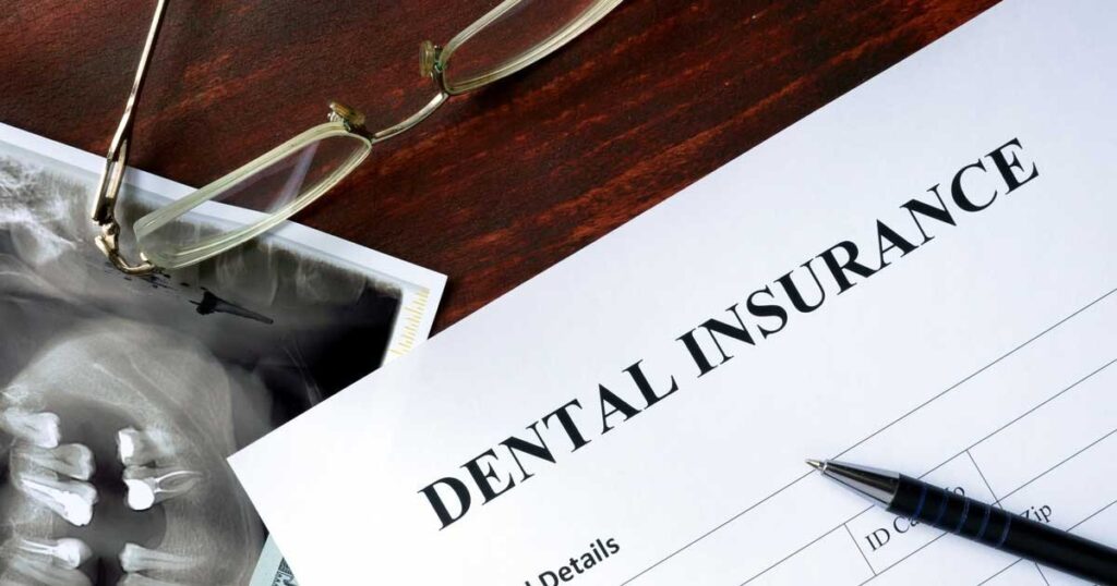 Frequently Asked Questions about Dental Insurance