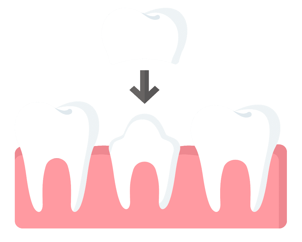 Kids Dental Crown Illustration
