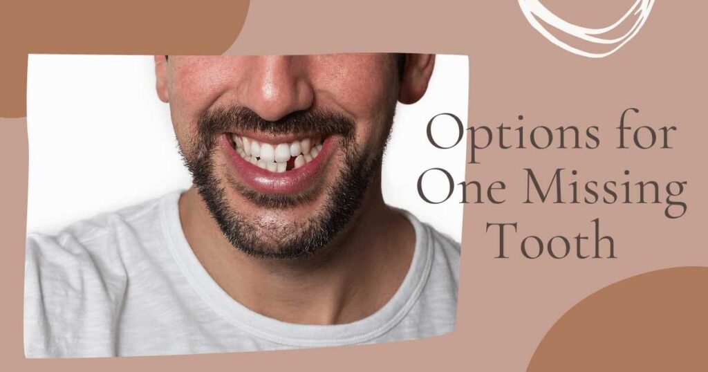 Options for One Missing Tooth