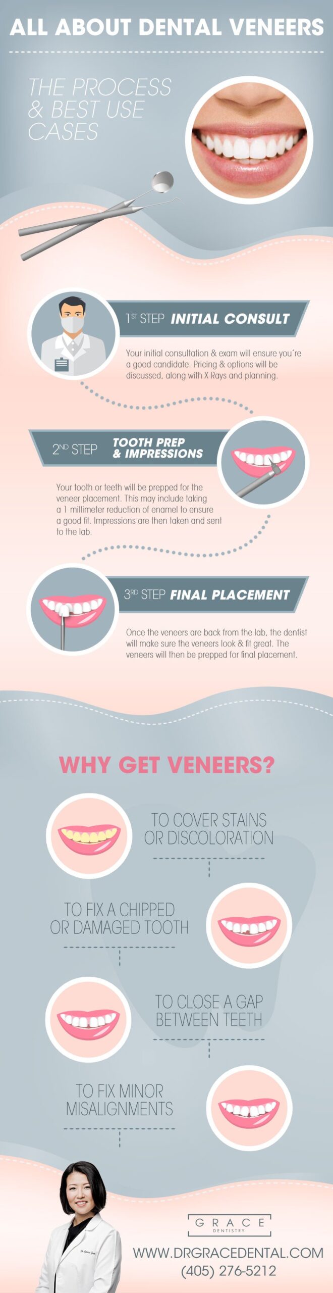 Porcelain Veneers Process & Best Use Cases Infographic