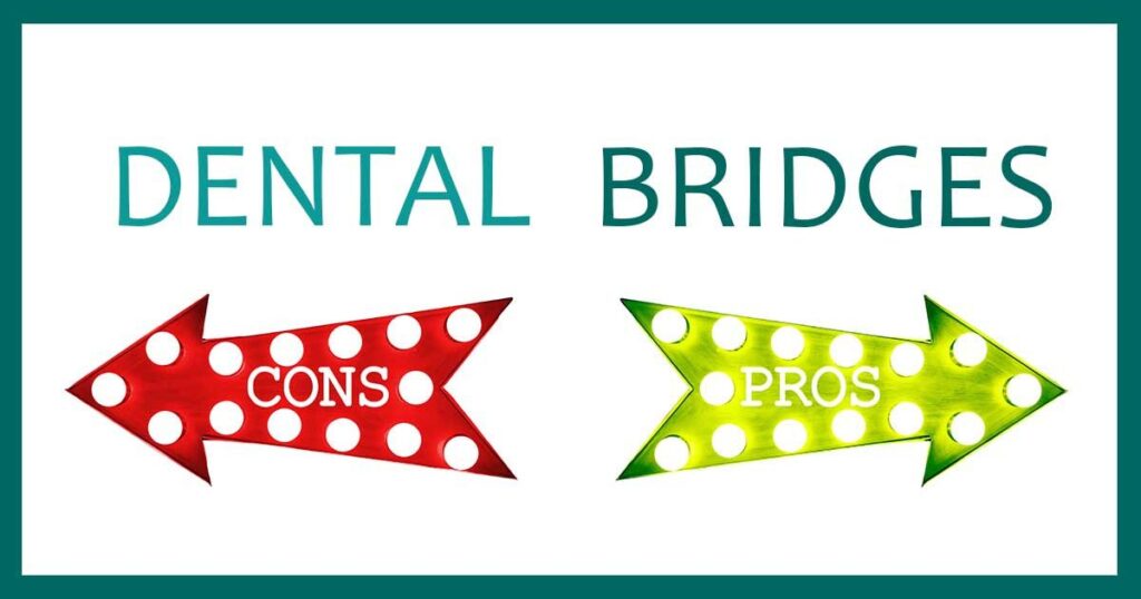Pros & Cons of Dental Bridges