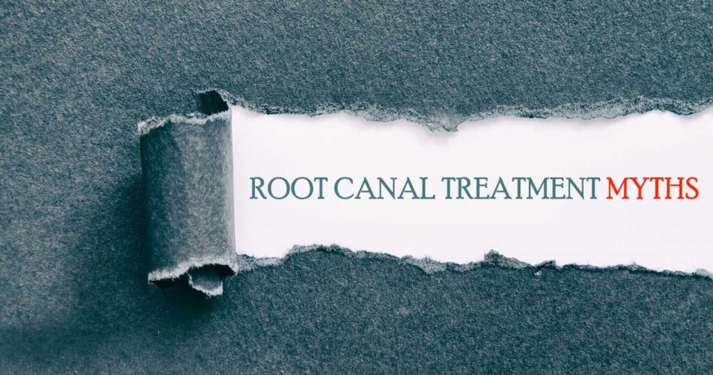 Root Canal Therapy Treatment Myths