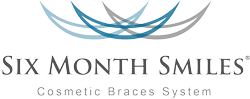 Six Month Smiles Cosmetic Braces System